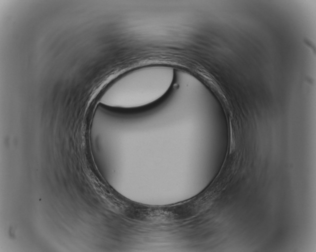 X0000102520387200808081035
