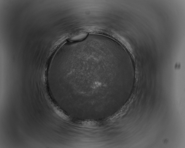 X0000102520105200808081437