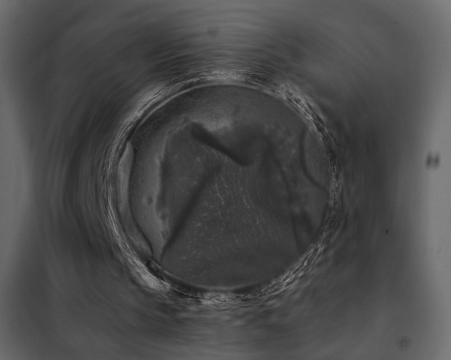 X0000102520145200808081435