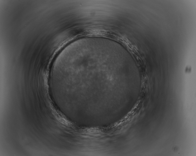 X0000102520146200808081435