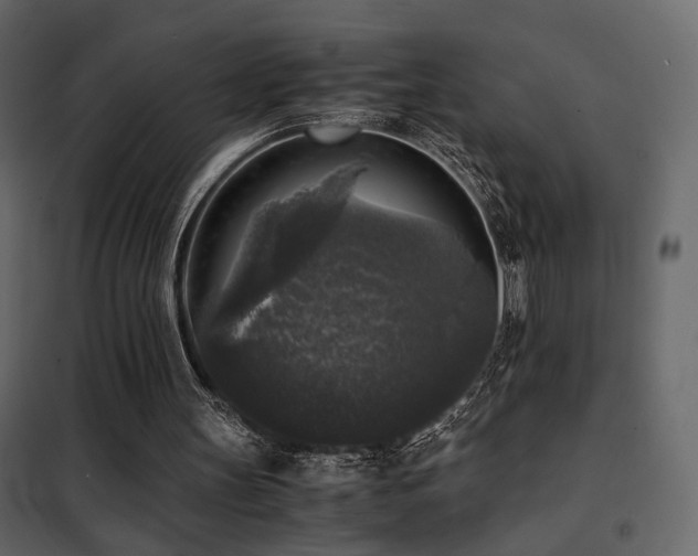 X0000102520147200808081435