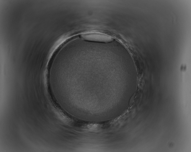 X0000102520152200808081435