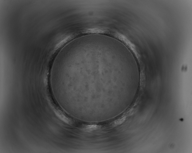 X0000102520153200808081435