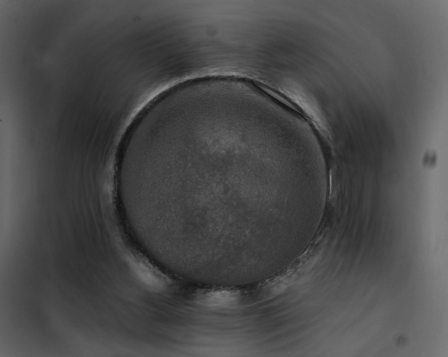 X0000102520156200808081435