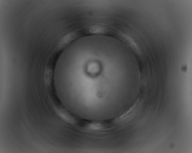 X0000102520171200808081436