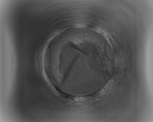 X0000102520145200808151540