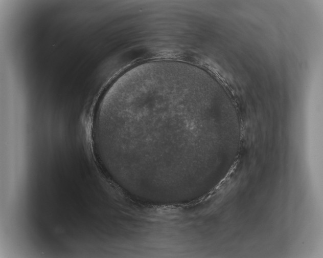 X0000102520146200808151540