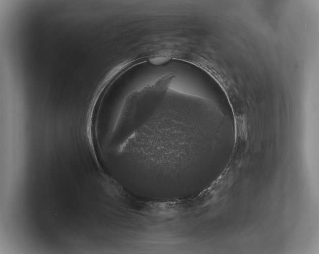 X0000102520147200808151540