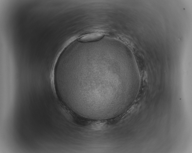 X0000102520148200808151540