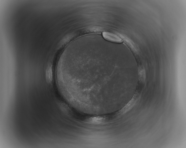 X0000102520158200808151540