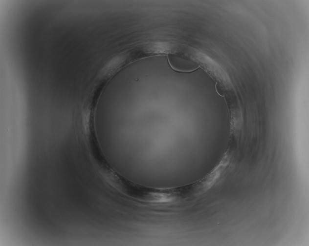 X0000102520167200808151541