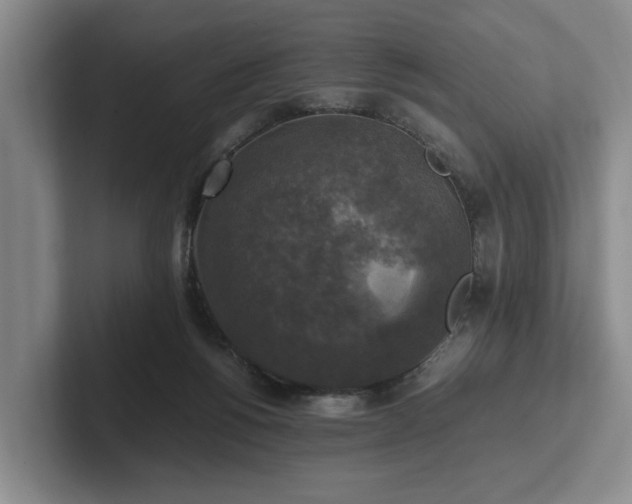 X0000102520168200808151541