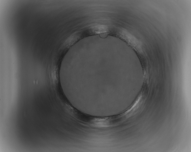 X0000102520170200808151541