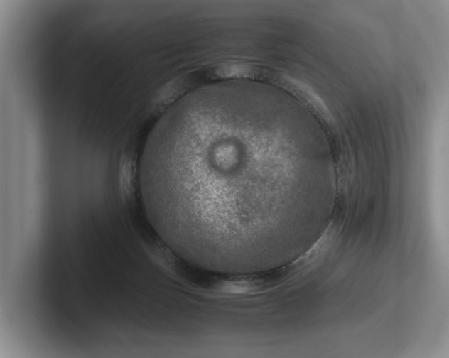 X0000102520171200808151541