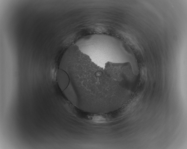 X0000102520177200808151541