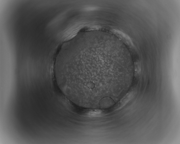 X0000102520369200808151538