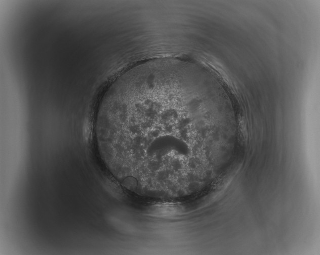 X0000102520499200808151536