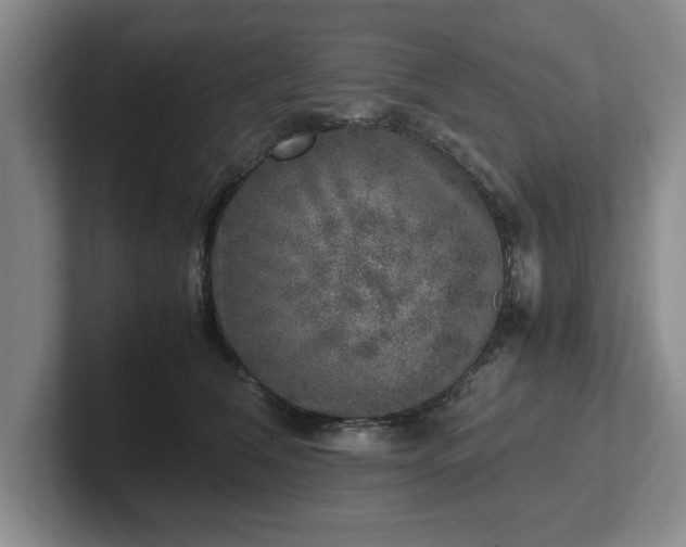 X0000102520612200808151535