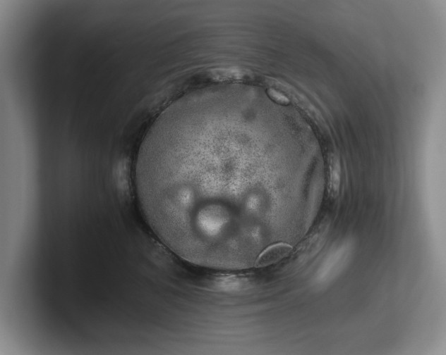 X0000102520616200808151534