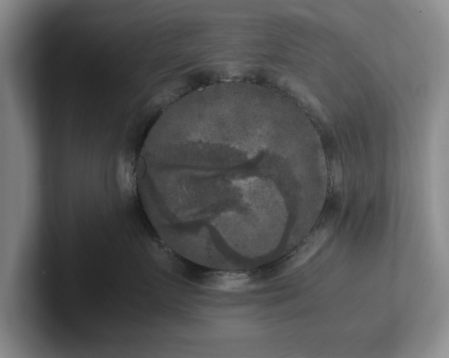 X0000102520719200808151533