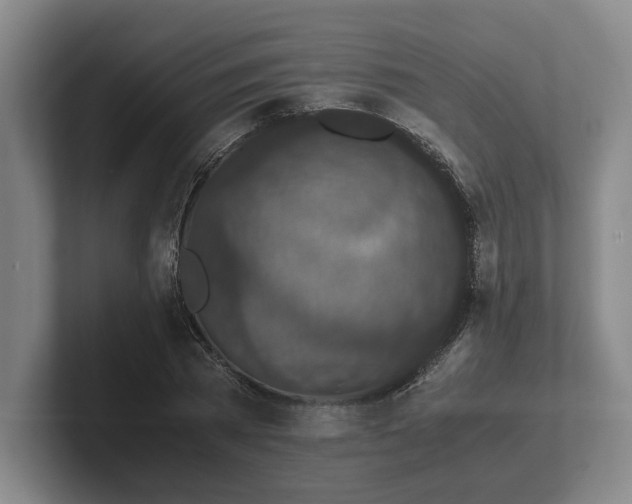 X0000102520785200808151532