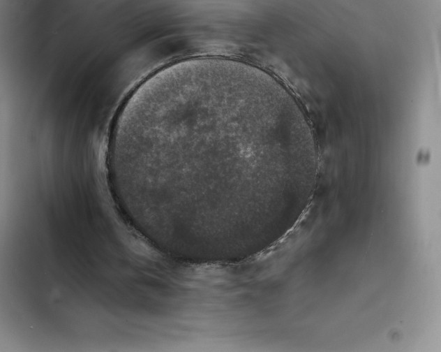 X0000102520146200808221849