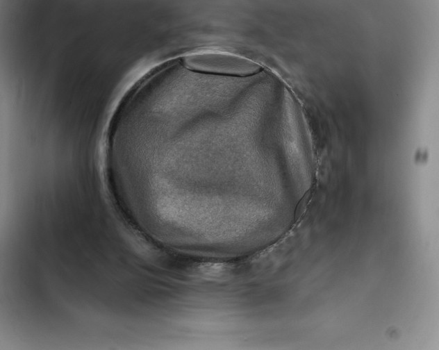 X0000102520152200808221849