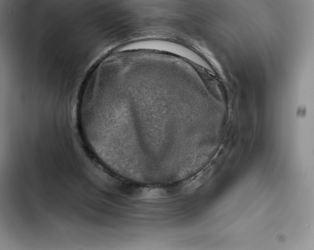 X0000102520154200808221849