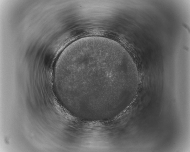 X0000102520146200808291805