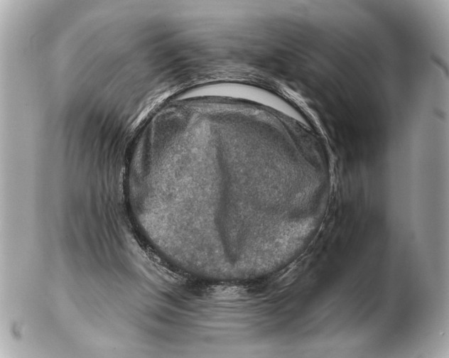 X0000102520154200808291805