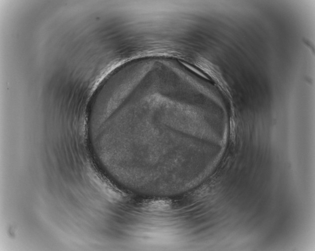 X0000102520156200808291805