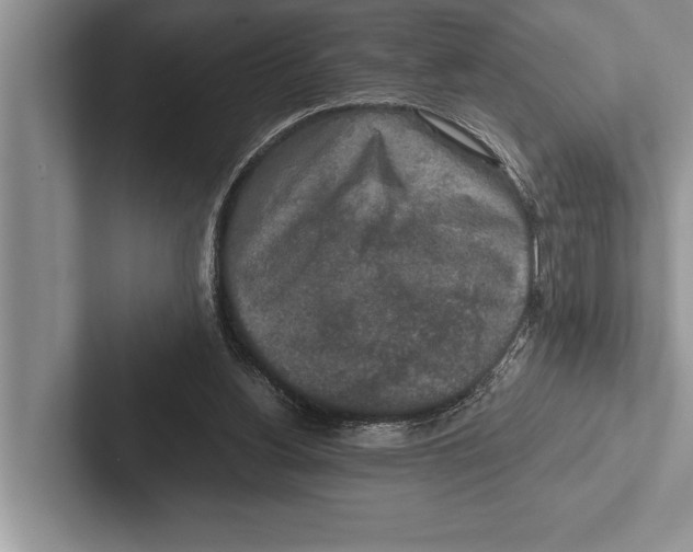 X0000102520156200809051451