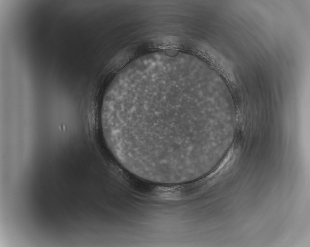 X0000102520170200809051451