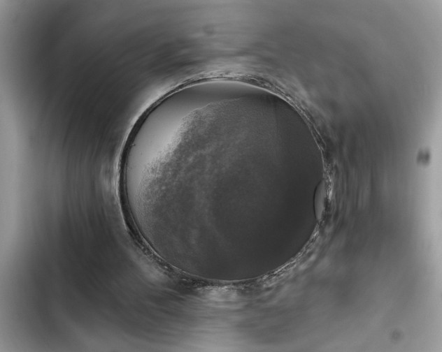 X0000102540100200808151652
