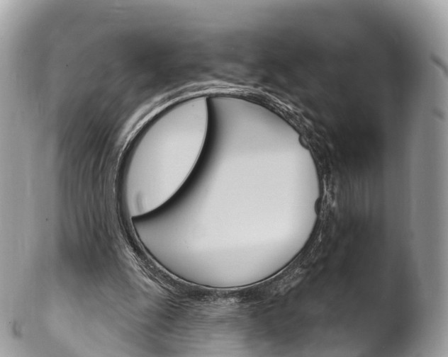 X0000102790247200808181000