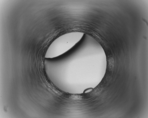 X0000102790617200808180955