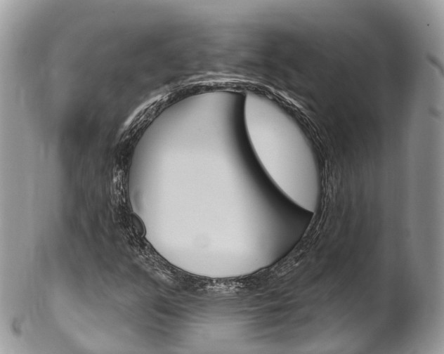 X0000102791351200808180945