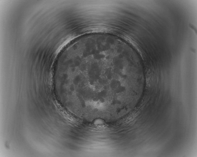 X0000102810975200808181219