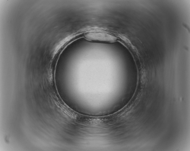 X0000102811167200808181217