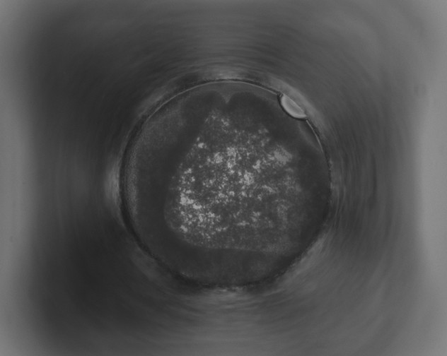 X0000102810386200808251114