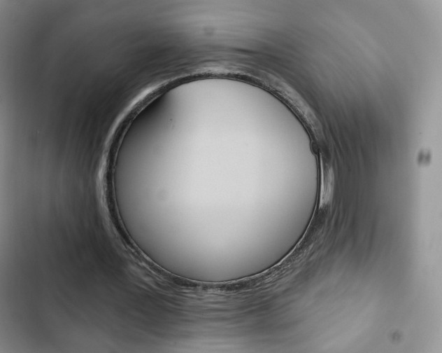 X0000102820387200808181030