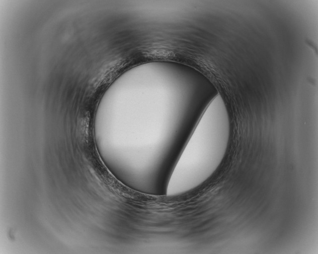X0000102840739200808181024