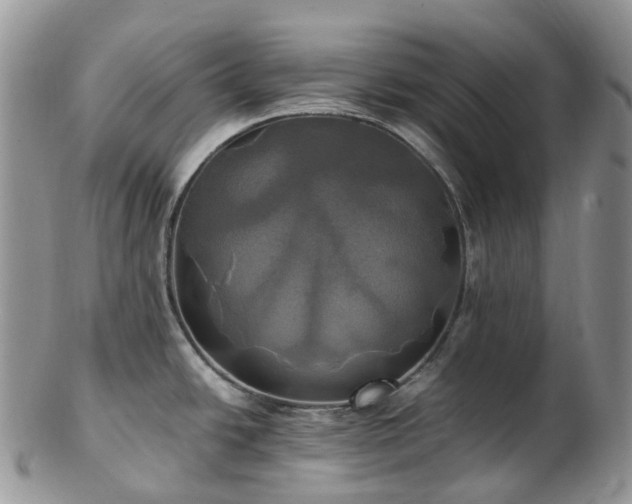 X0000102841438200808251146