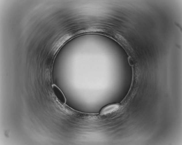 X0000102851177200808181040