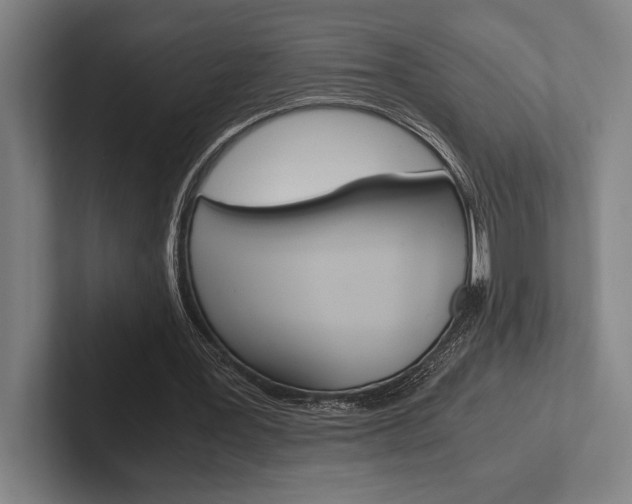 X0000102860387200808181030