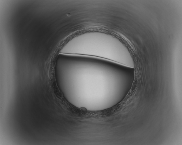 X0000102860775200808181025