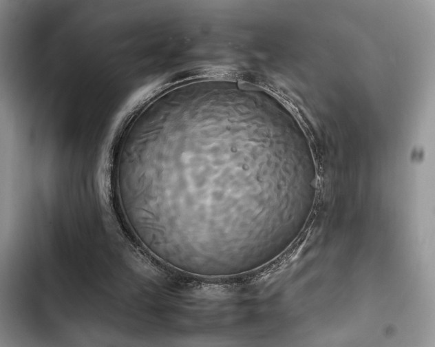 X0000102860149200808181450