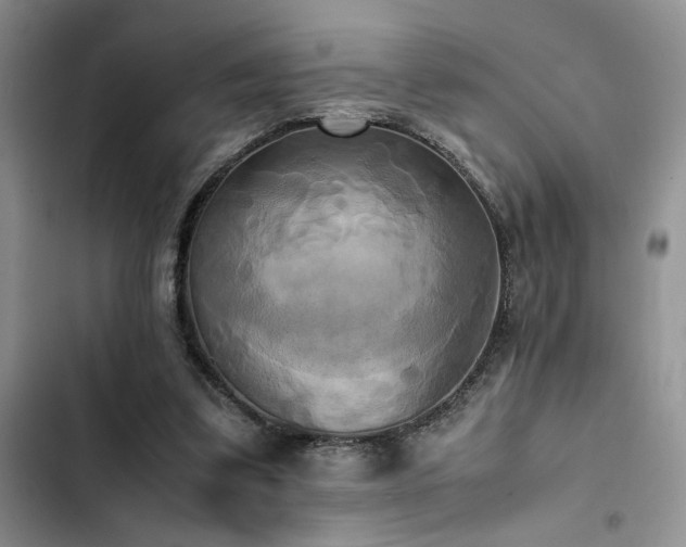 X0000102860299200808181448