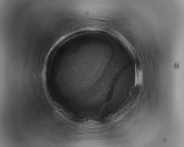 X0000102860387200808181446