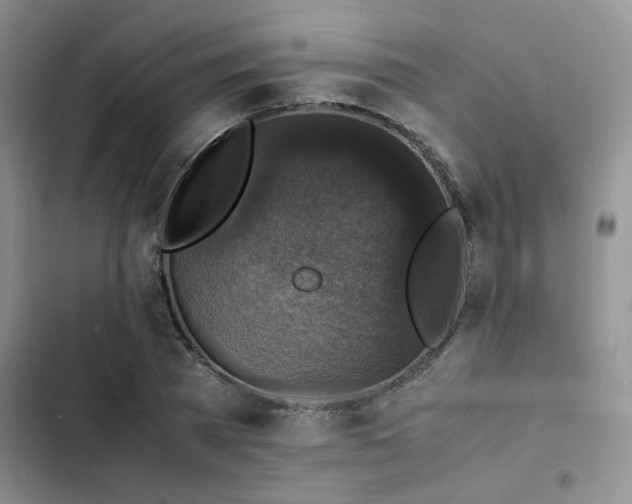 X0000102860785200808181440